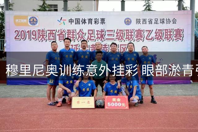 穆里尼奥训练意外挂彩 眼部淤青引热议